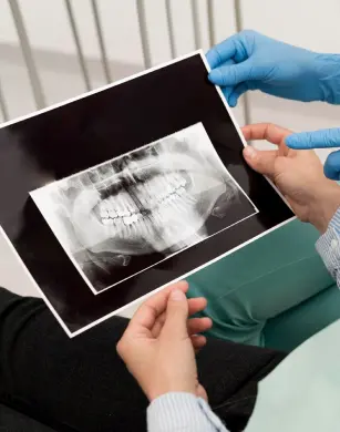 Панорамний знімок щелепи перед імплантацією зубів в Ужгороді – точна діагностика для успішного лікування в клініці Picasso.