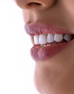 Відкрийте для себе ідеальну усмішку з нашими високоякісними вінірами