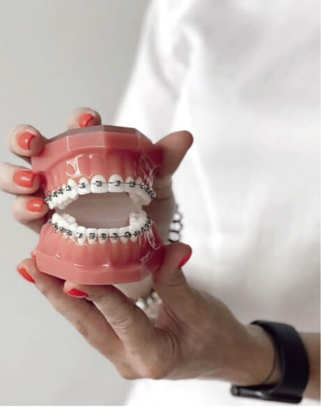 Як працюють брекети: продумана фізика, а не сила