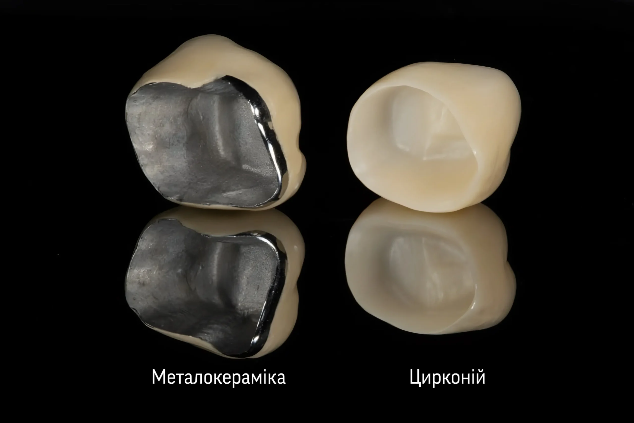 Порівняння коронок: металокераміка та цирконій у стоматології PICASSO в Ужгороді