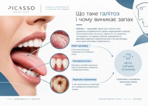 що таке галітоз